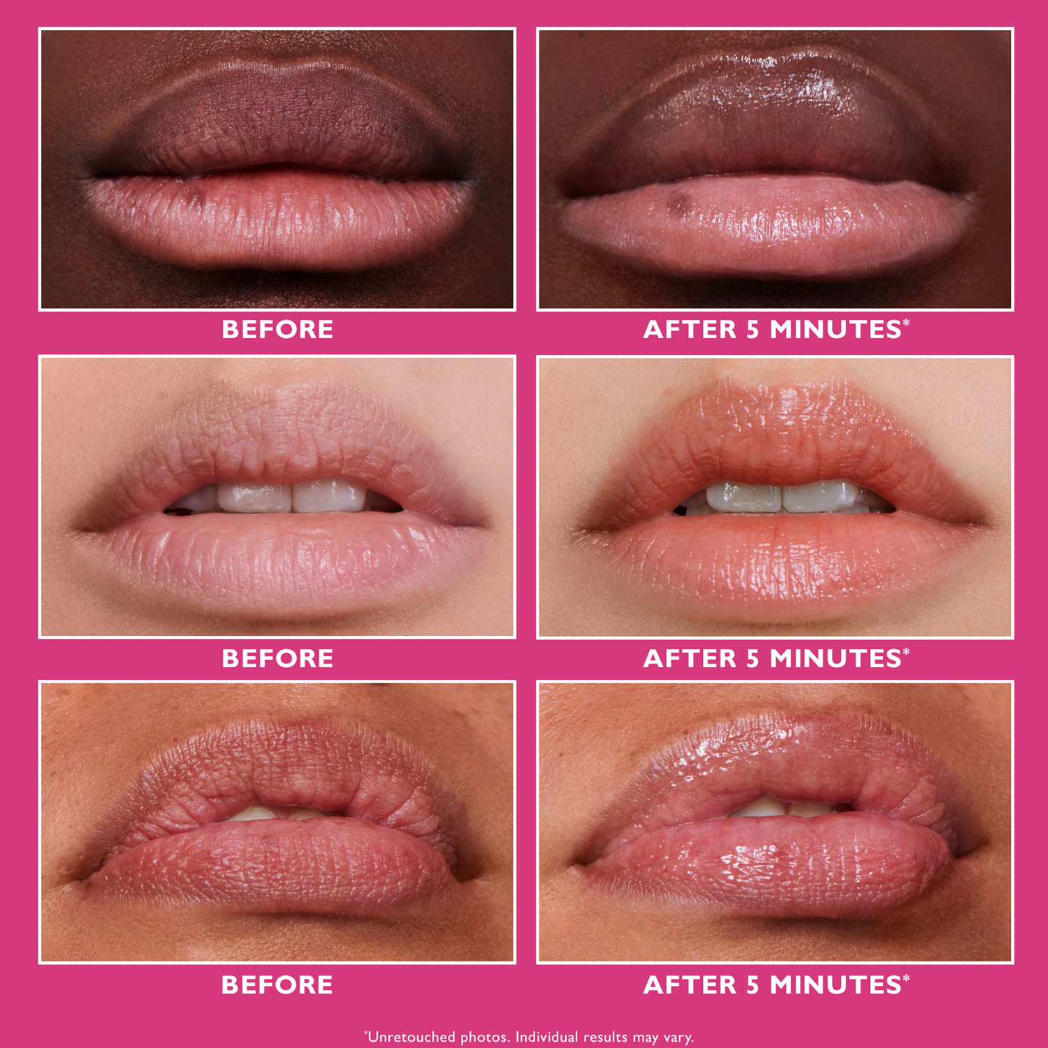 Instant Firmx® Lip Filler